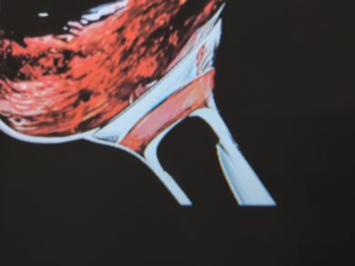 Test image: Short distance